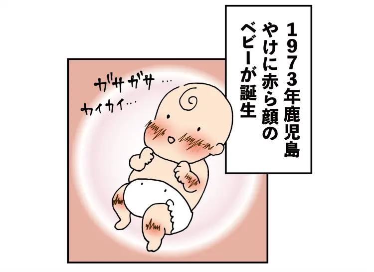 1973年鹿児島、やけに赤ら顔のベビーが誕生