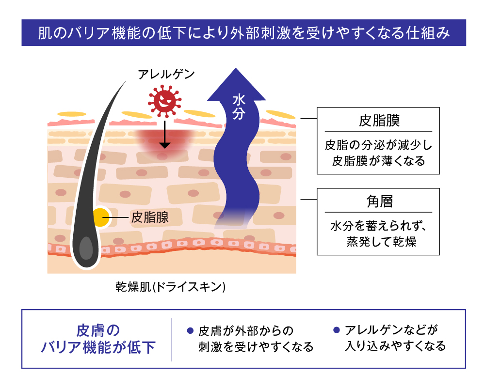1. 乾燥肌とは：肌の水分が不足している状態